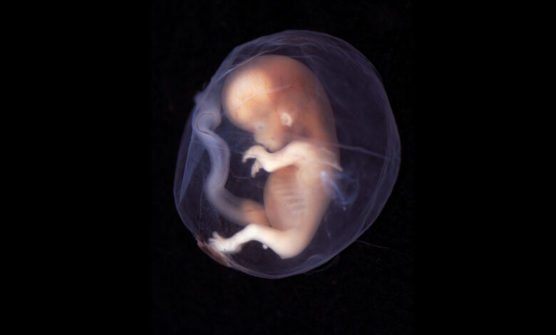 Un embryon âgé de 9 à 10 semaines.